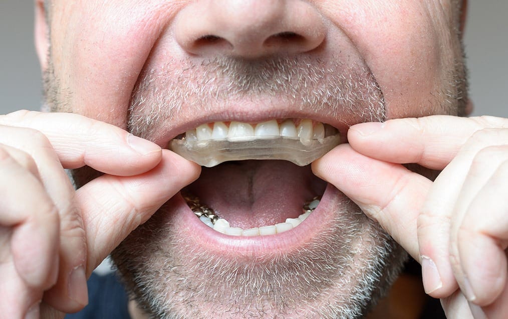 Night Guards | Team Smile Dentistry | General & Family Dentist | Fonthill | Ontario