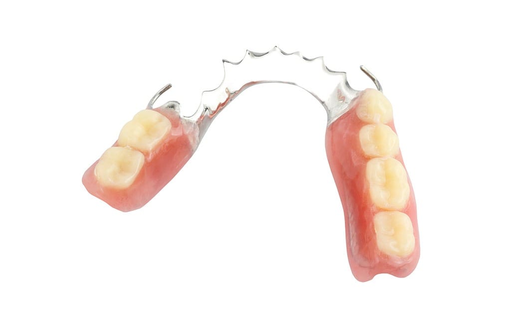 partial-dentures-team-smile-dentistry-fontham-pelham-general-and-family-dentist Partial Dentures | Team Smile Dentistry | General & Family Dentist | Fonthill | Ontario
