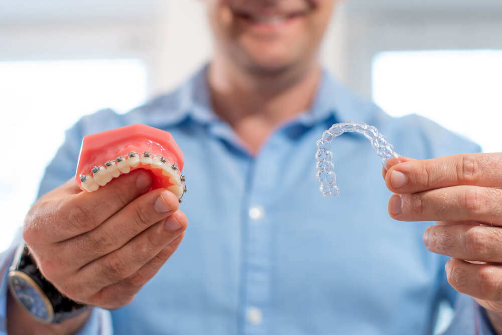 Invisalign vs braces | teeth straightening | comparison